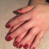 Shellac